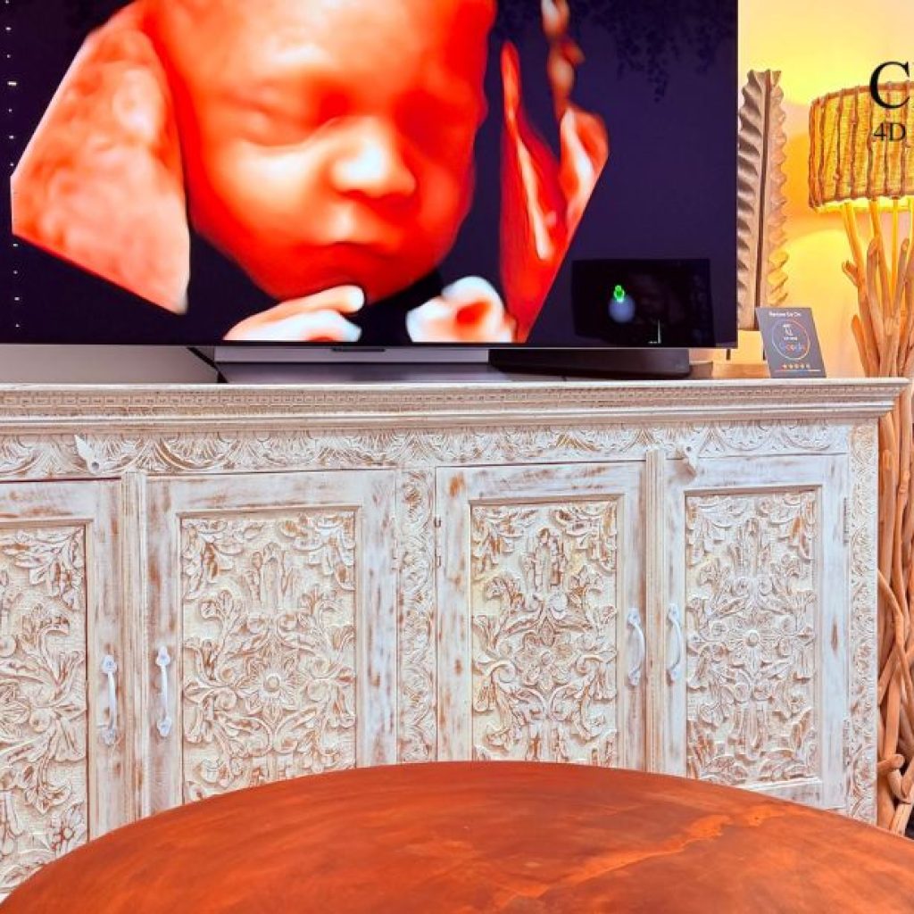 Discover expert ultrasound scans in Western Australia with a trusted Perth studio
