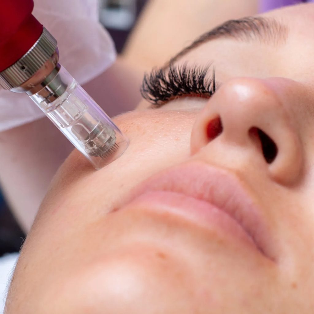 Hair & Skin Clinic In London | Thecheclinic.co.uk Hair & Skin Clinic In London | Thecheclinic.co.uk