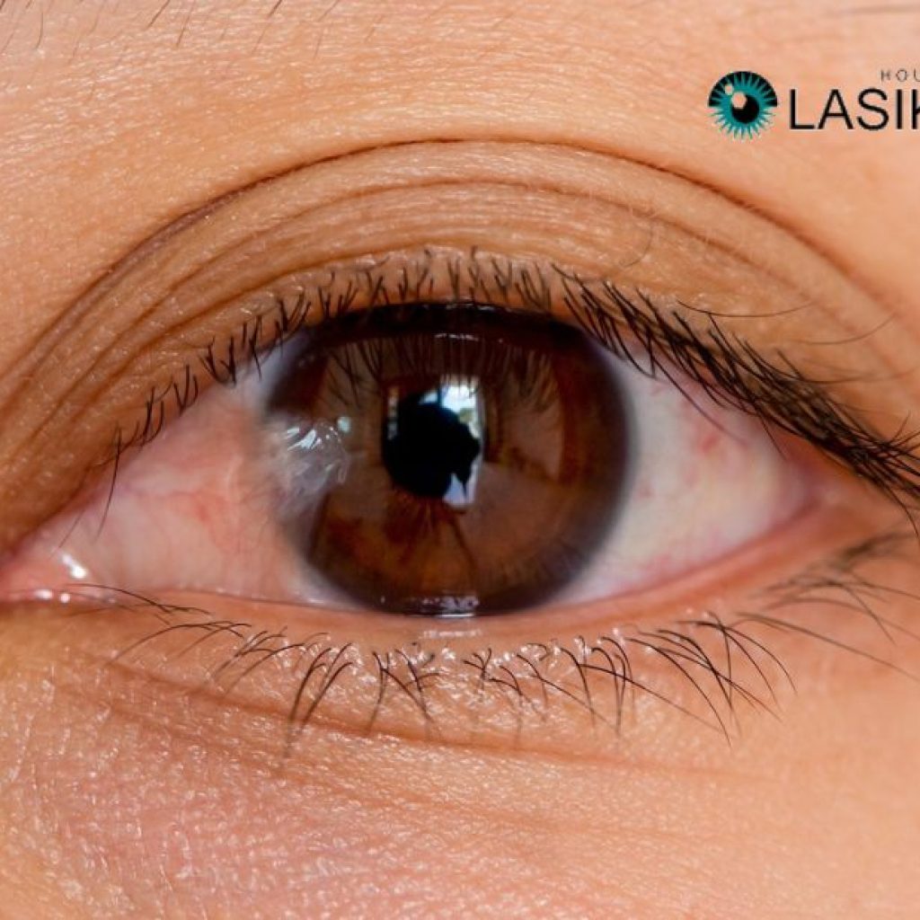 Relief for pterygium symptoms with expert eye drops