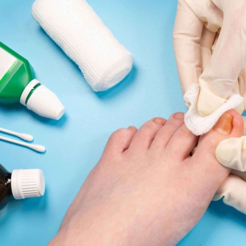 Gentle Nail Care for Seniors: Safe, Friendly Foot Services