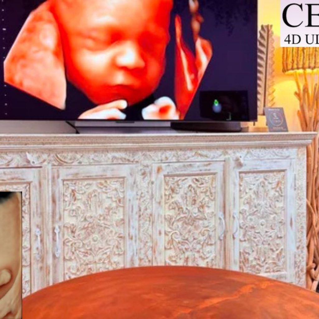 Experience crystal-clear baby imaging during your Perth ultrasound session Experience crystal-clear baby imaging during your Perth ultrasound session