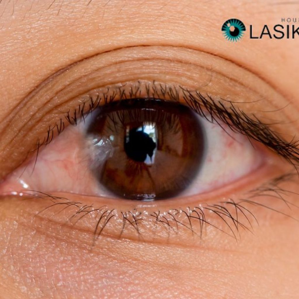 Effective Pterygium Removal: Restore Your Vision with Expert Eye Care Effective Pterygium Removal: Restore Your Vision with Expert Eye Care