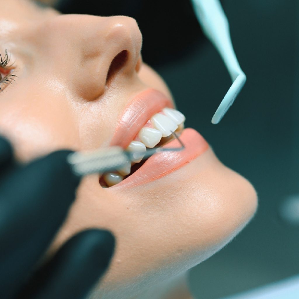 Discover Subtle, Confident Teeth Aligning in Charlotte, NC