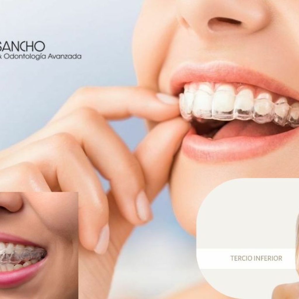 Sonrisa saludable en Pozuelo: clínica dental de confianza