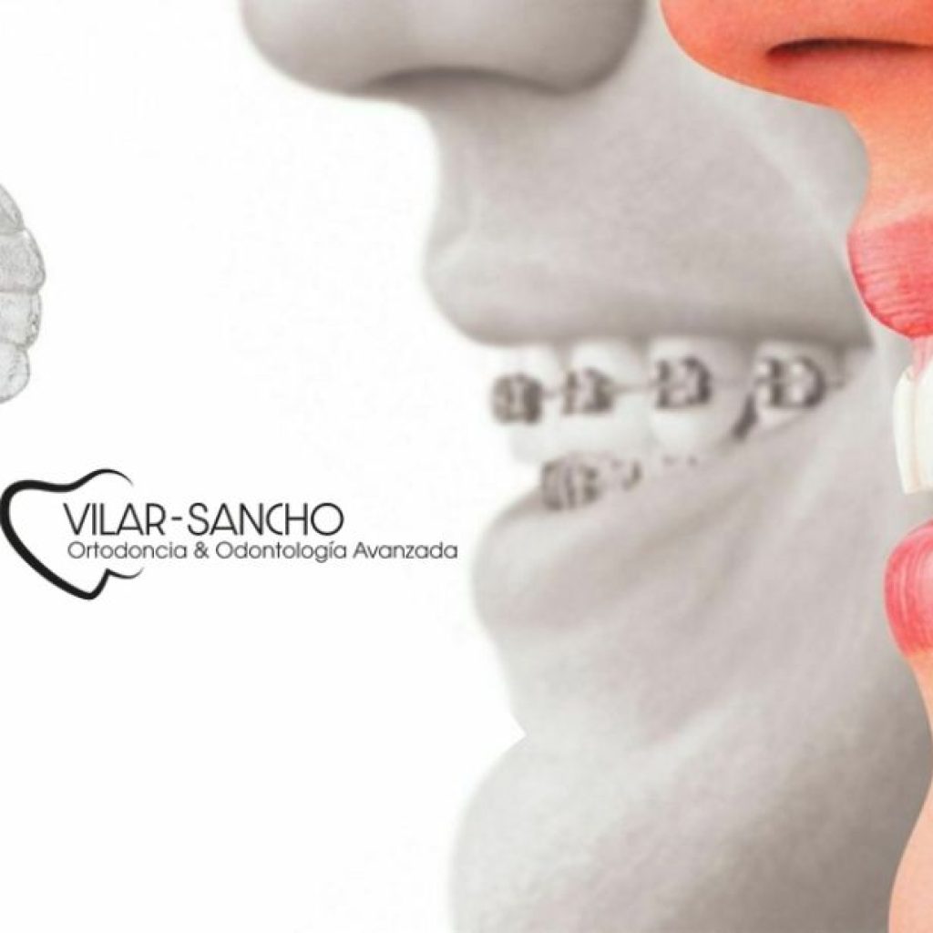 Sonrisa saludable en Pozuelo: atención dental cercana y profesional