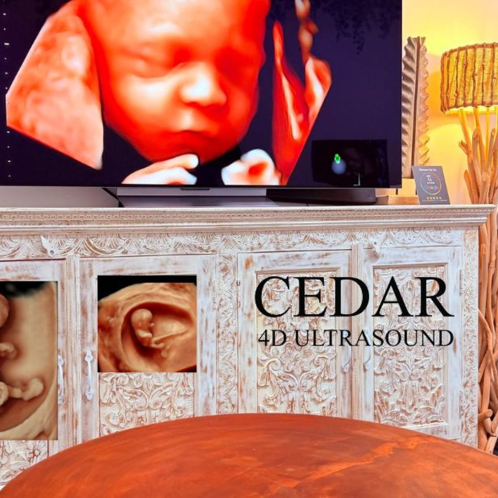 Capture your baby’s first moments with 3D/4D ultrasound in Perth