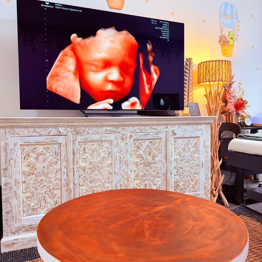 Gentle, welcoming scans for expectant families in Perth