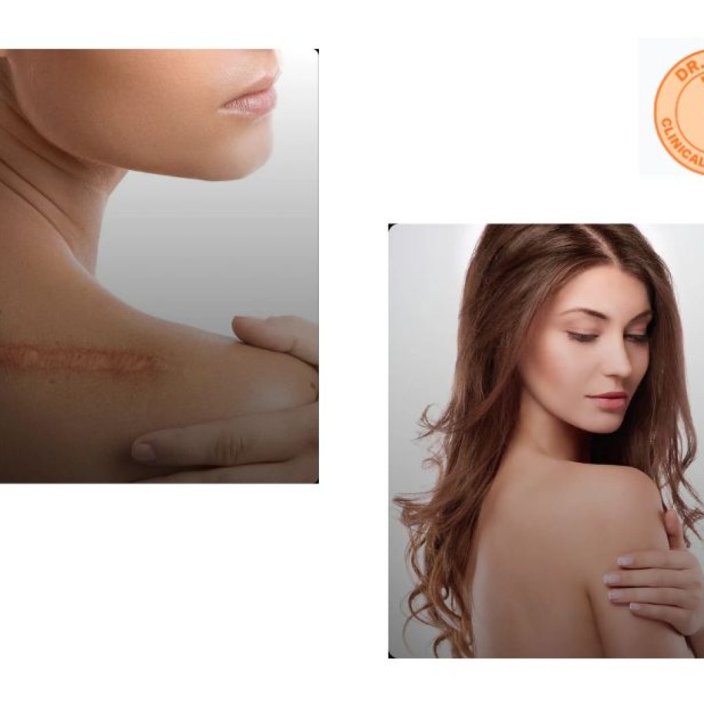 Achieve Defined Abs: Expert Body Contouring in Malaysia