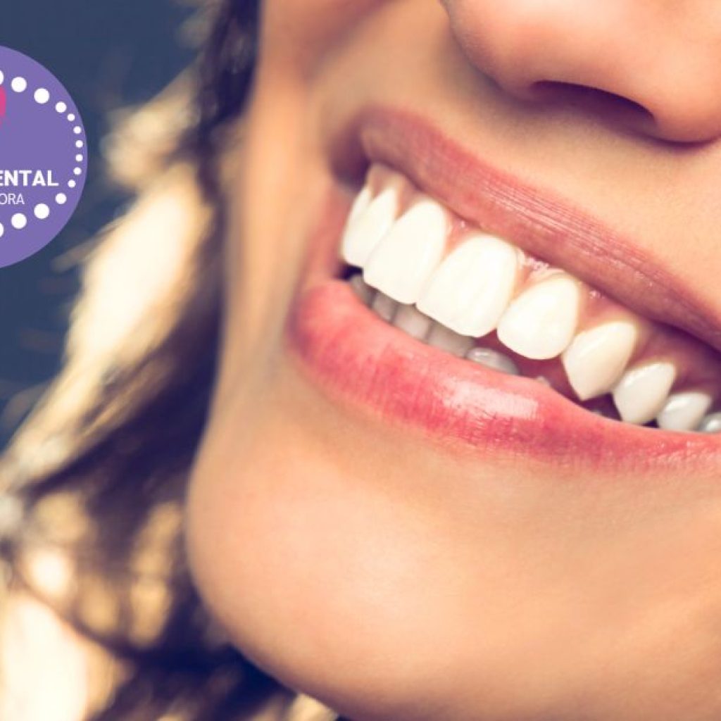 Somriures de referència a la teva ciutat: estètica dental professional
