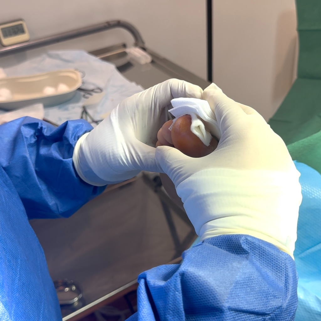 Relieve painful toenail issues fast with expert care and same-day options