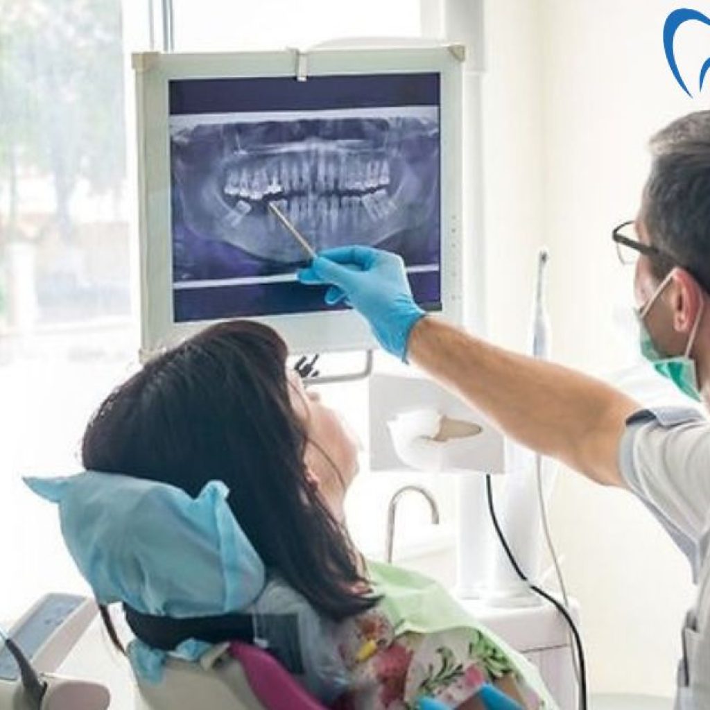 Top Implant Dentist in Orleans: Restore Your Smile with Confidence