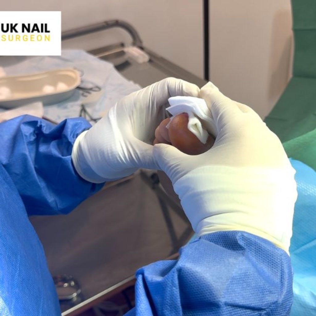 Relief at last: Effective treatment for painful toenails