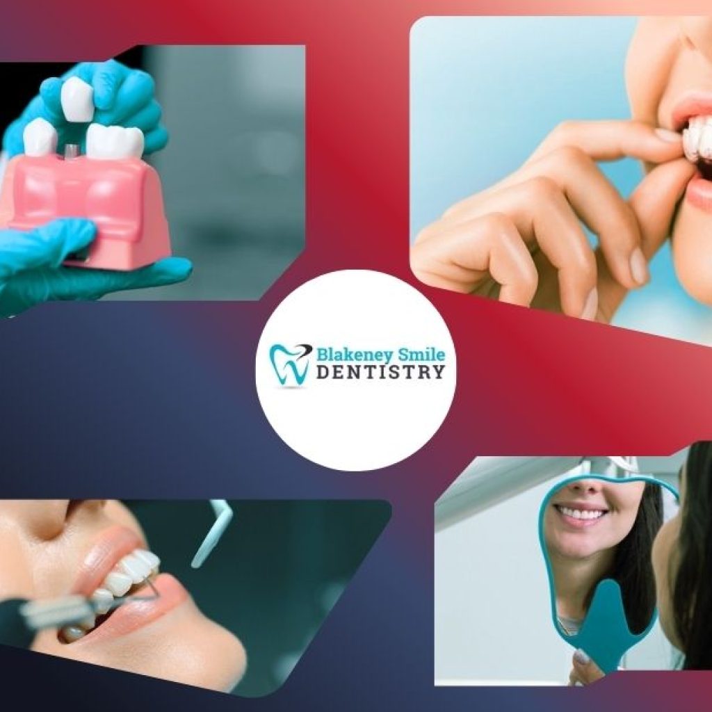 Restore Your Smile with Expert Implant Dentistry in South Carolina
