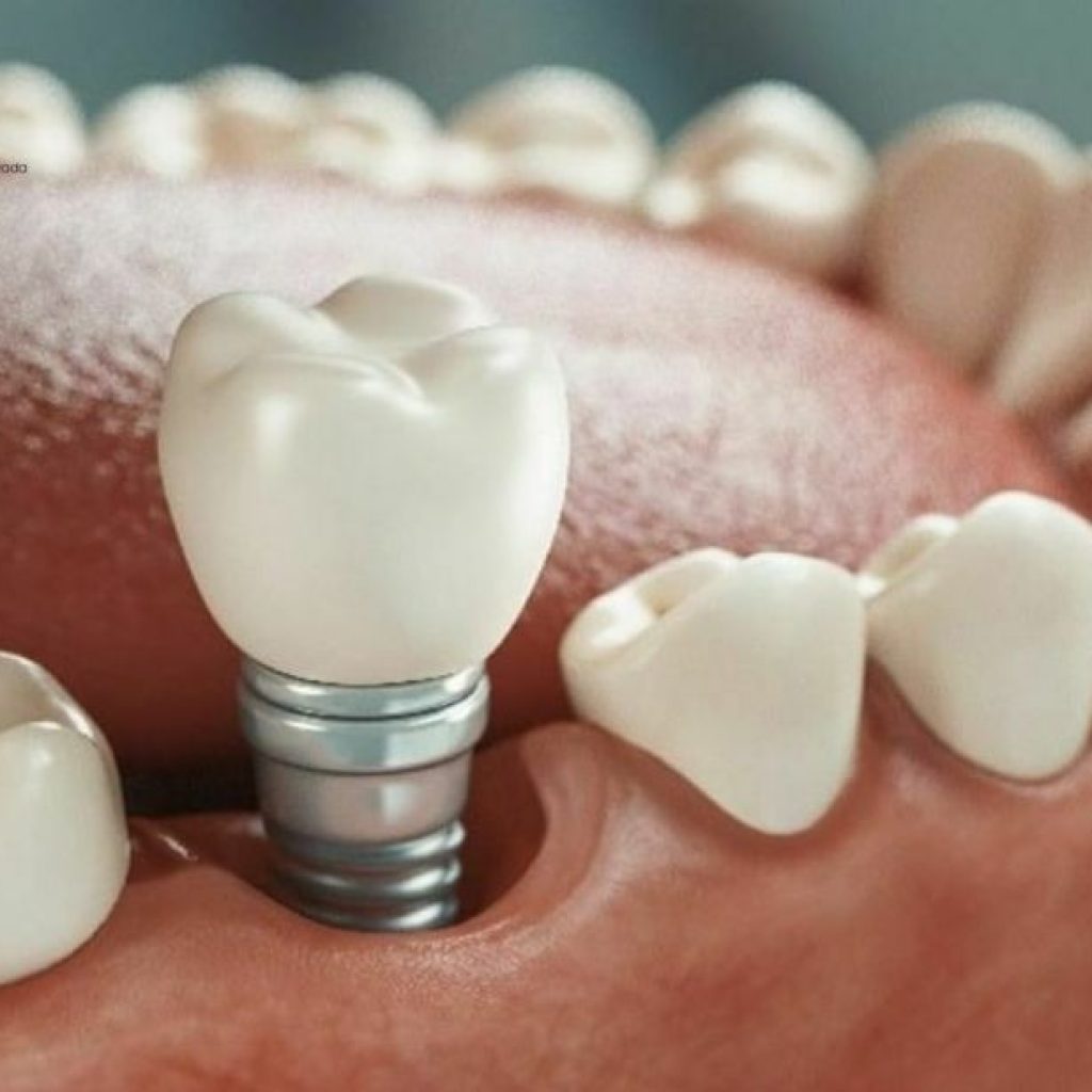 Atención dental urgente en Pozuelo: calma y rapidez